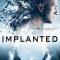 Implanted