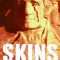 Skins